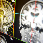 对7岁儿童大脑活动的扫描有助于东北大学的研究人员预测青少年的抑郁、焦虑和注意力问题的症状。Ruby Wallau/东北大学摄影raybet雷竞技雷竞技app最新版