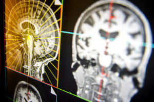 对7岁儿童大脑活动的扫描有助于东北大学的研究人员预测青少年的抑郁、焦虑和注意力问题的症状。Ruby Wallau/东北大学摄影raybet雷竞技雷竞技app最新版