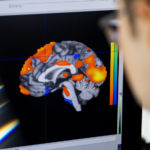 一个脑部扫描的图像出现在电脑上