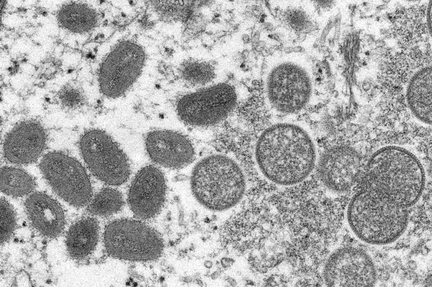 显微镜下猴痘病毒的黑白照片